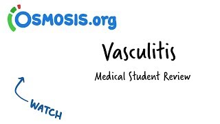 Vasculitis  Clinical Presentation [upl. by Hardigg]