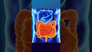 Understanding Colon Cleansing Insights from a Medical Professional [upl. by Marih]