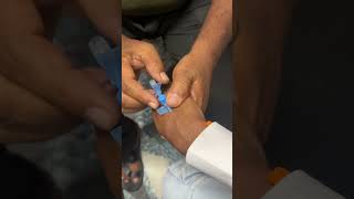 Intravenous Cannulation  cannula fixing  iv cannula fixing  learn to intravenous Cannulation [upl. by Imugem813]