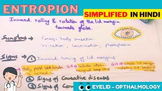 Entropion  Hindi  Opthalmology [upl. by Shuler]