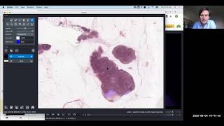 Multidimensional image visualization in Python using napari NEUBIAS AcademyHome webinar [upl. by Rdnaskela16]