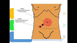 1 Dolor abdominal Clasificación Fisiopatología  Etiologías [upl. by Fina]