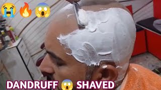 Attractive dandruff head shaved skin 🇮🇳😱🪒 [upl. by Anemolihp]