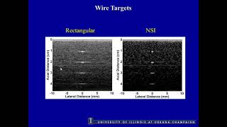 Improving Lateral Resolution In Ultrasonic Imaging By Utilizing Nulls In The Beam Pattern [upl. by Eentirb]