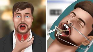 ASMR Animation Remove fish bones stuck in MrBeasts throat [upl. by Attolrac]