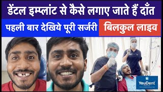 Complete Procedure of Dental implant  Best Teeth Implant Hospital in India  Implant By DR Rajesh [upl. by Aicilyhp]