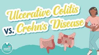 Ulcerative Colitis vs Crohns Disease  Know the Difference  Med Surg Help for Nursing School [upl. by Midan]