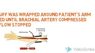 Sphygmomanometer principle [upl. by Ahtan]