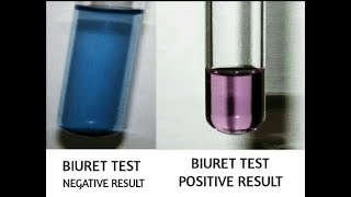 Biuret Test for Protein Everything Included  Biuret Test for Urea  Biuret Test [upl. by Starla]