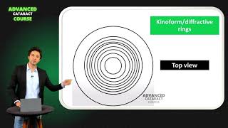 Basic Principles of Multifocal IOLs [upl. by Annoed]