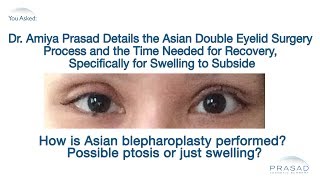 The Asian Double Eyelid Surgery Process and Why Temporary Swelling Occurs [upl. by Fabrianna700]