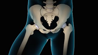 Minimally Invasive Total Hip Replacement  THR  Nucleus Health [upl. by Sonya]