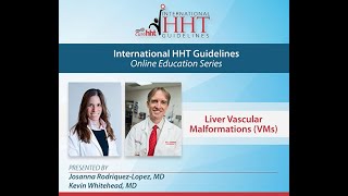 International HHT Guidelines Liver Vascular Malformations VM [upl. by Tullius]