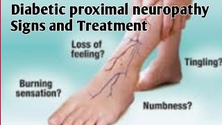 Diabetic proximal NeuropathySymptoms and TreatmentHTN Medical MediaNucleus medical media [upl. by Redmer]