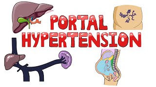 Portal Hypertension  Causes of Portal Hypertension PreIntraPost Hepatic  Symptoms amp Diagnosis [upl. by Haidebez]