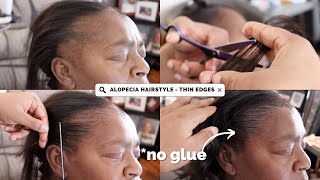 THIN EDGES TRANSFORMATION  TRACTION ALOPECIA HAIRSTYLE [upl. by Huang]