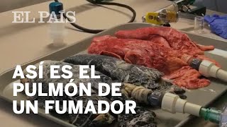 Así se transforma el pulmón de un fumador [upl. by Novahs530]