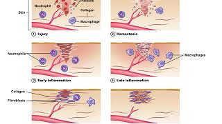 Diabetes Part 3 of 3 [upl. by Franzoni]