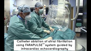 Catheter ablation of atrial fibrillation [upl. by Chandal]