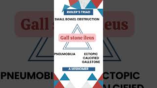 Riglers Triad Key Signs of Gallstone Ileus Explained gallbladderproblems MedicalEducation [upl. by Marmaduke]