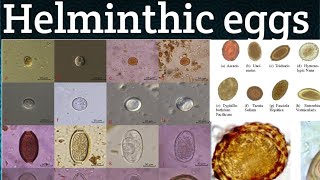 Different ParasiticHelminthic eggs ll Vet Parasitology ll TrematodesCestodesNematodesVetjunction [upl. by Ellehsal]