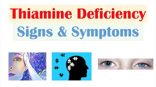 Thiamine Vit B1 Deficiency Signs amp Symptoms amp Why They Occur [upl. by Leahpar]