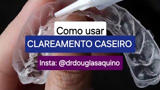 Insta drdouglasaquino  Orientação sobre clareamento caseiro de moldeira [upl. by Alyag]