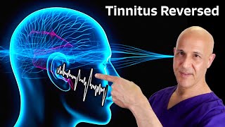 Tinnitus Reversed The Miracle of 1 Nutrient Dr Mandell [upl. by Meir]