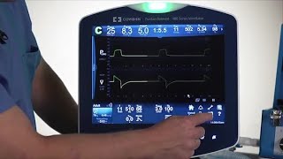 Puritan Bennett™ 980 Ventilator Basic Lesson Constant Access Icons [upl. by Ateuqram]