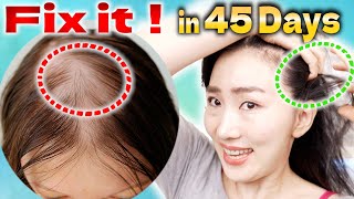 Scalp Lymphatic Drainage Massage to Improve Thinning Hair in 45 Days [upl. by Akir]