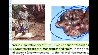 Non spore forming gram positive rods [upl. by Chaves672]