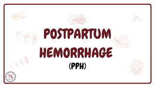 Postpartum Hemorrhage  Types  Causes  Diagnosis  Medical Management  Nursing Management [upl. by Cleary]