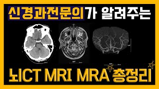 신경과전문의가 알려주는 뇌CT MRI MRA 총정리 뇌CT 뇌MRI 뇌MRA 어떨때어떤뇌검사 뇌검사 뇌검사총정리 신경과전문의 신경과 부산신경과 손제용 [upl. by Florio]