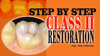 Step by Step Class II Direct Composite Restoration  Operative Dentistry Polofil® NHT  VOCO GmbH [upl. by Anagrom979]