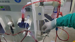 Air embolism during dialysis How to remove air during dialysis [upl. by Ennaitsirk]