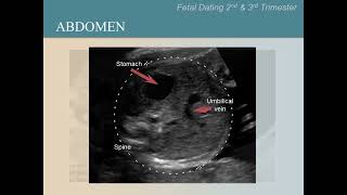 Ultrasound Training Course 06 part 2 [upl. by Roxanne]