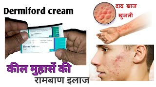 Dermiford cream full review benifitside effects amp usehindi [upl. by Horner]