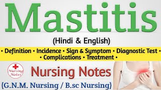 Mastitis  Mastitis In Hindi Nursing Lecture [upl. by Analad]