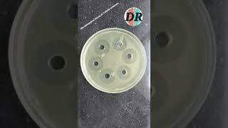 Microbiological Assay of Antibiotics [upl. by Noxid]