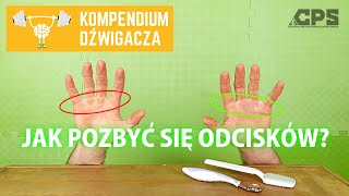 Jak pozbyć się odcisków  nagniotki czy pęcherze z surowicą  CPS [upl. by Boony]