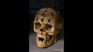 Like a Hole in the Head A History of Trepanning [upl. by Adrial]