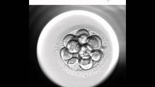 Embryoscope 2  Nuevo método de cultivo y selección embrionaria [upl. by Htebasil]