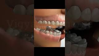 Jaw Treatment teeth dentist health [upl. by Epillihp]