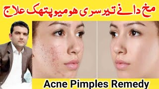 Acne Pimples Treatment in Pashto Language  wrinkles freckles remedy in pashto language  pukhto [upl. by Aynor126]