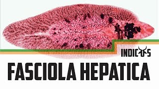 Fasciola hepatica [upl. by Enomys]