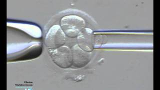 Embryo Biopsy technique video Part1 [upl. by Relly]