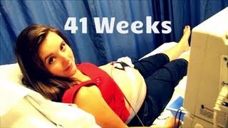 41 Weeks Pregnant  Ultrasound  Membrane Sweep [upl. by Lleoj119]