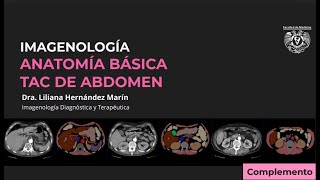 TAC DE ABDOMEN  ANATOMÍA RADIOLÓGICA BÁSICA [upl. by Sloatman]