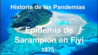 Epidemia de Sarampión en Fiyi 1875 Historia de las Pandemias Episodio 10 [upl. by Adnorahs]