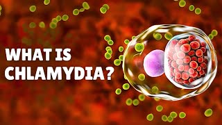 Chlamydia STI – Causes Signs and Symptoms Diagnosis amp Treatment [upl. by Schlessinger811]